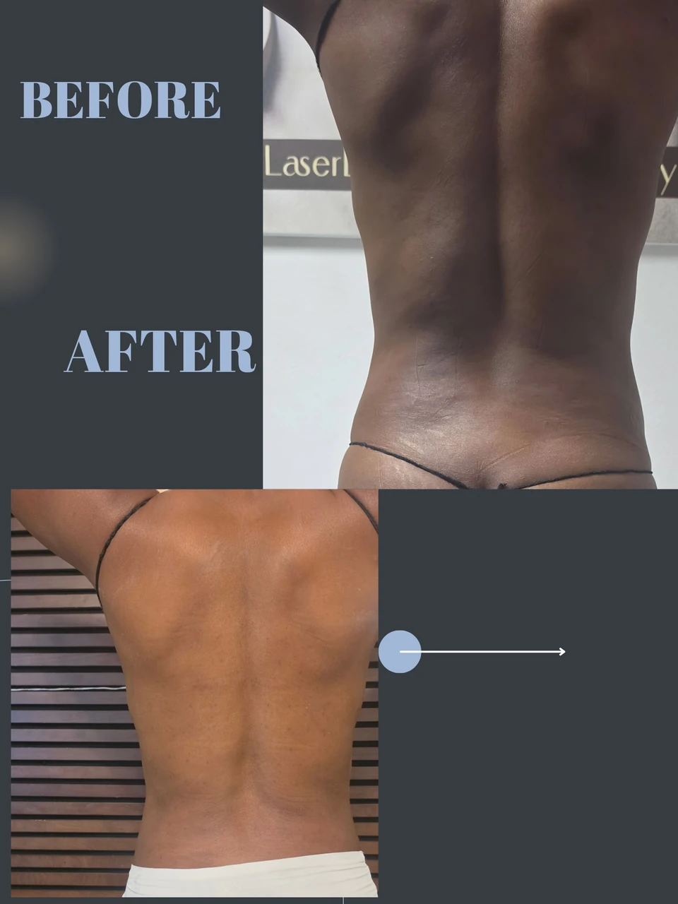NDB-published before-and-after comparison composite. Original BEFORE/AFTER labels, watermark and embedded caption are preserved.